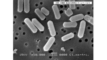 生徒50人に『ウエルシュ菌』の症状 運動部員の食堂で食中毒【新潟県】帝京長岡高校