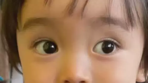 子どもが急に“パッチリ二重”に…「これはやばい」なぜ？　保護者が戦々恐々とするワケ　医師が解説…まぶたの状態でわかる“体調変化”とは？