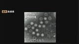 「三寒四温で免疫力低下…ノロウイルスなどによる感染性胃腸炎にご用心　島根県は「冬季の食中毒注意報」発表」の画像1