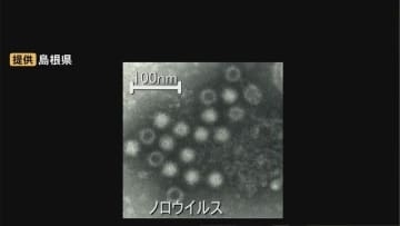 三寒四温で免疫力低下…ノロウイルスなどによる感染性胃腸炎にご用心　島根県は「冬季の食中毒注意報」発表