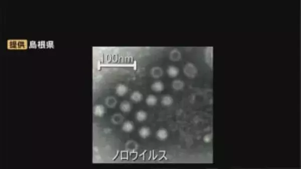 三寒四温で免疫力低下…ノロウイルスなどによる感染性胃腸炎にご用心　島根県は「冬季の食中毒注意報」発表