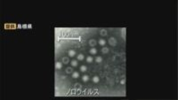 三寒四温で免疫力低下…ノロウイルスなどによる感染性胃腸炎にご用心　島根県は「冬季の食中毒注意報」発表