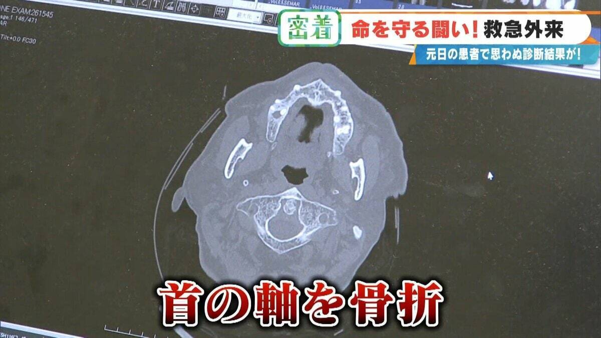 衣服に血の跡がべったりと…「首の軸が粉砕」“茶色いもの”で吐血疑い 緊急事態の原因は？命と向き合う救急外来ERに密着