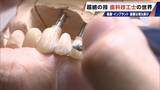 「“入れ歯難民”に？減り続ける歯科技工士 現役の約半数が50歳以上 デジタル普及しても…かみ合わせはやっぱり“人間の手”」の画像1