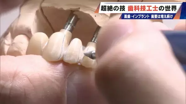 “入れ歯難民”に？減り続ける歯科技工士 現役の約半数が50歳以上 デジタル普及しても…かみ合わせはやっぱり“人間の手”