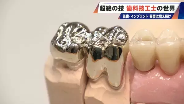 「“入れ歯難民”に？減り続ける歯科技工士 現役の約半数が50歳以上 デジタル普及しても…かみ合わせはやっぱり“人間の手”」の画像