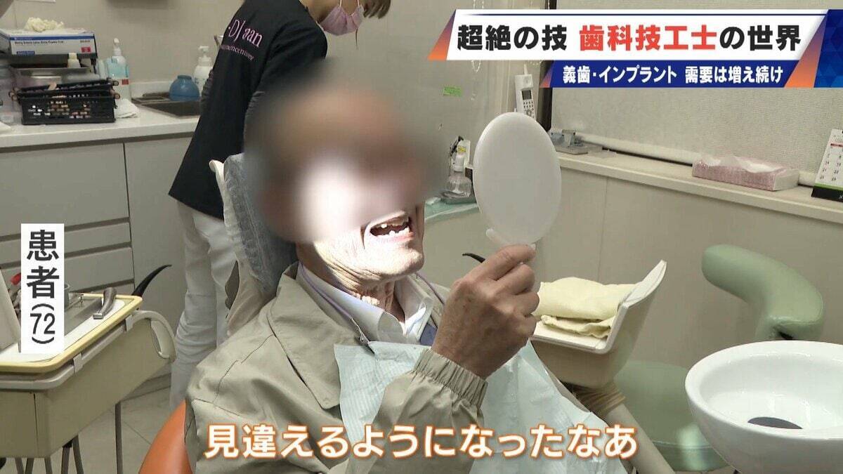 “入れ歯難民”に？減り続ける歯科技工士 現役の約半数が50歳以上 デジタル普及しても…かみ合わせはやっぱり“人間の手”
