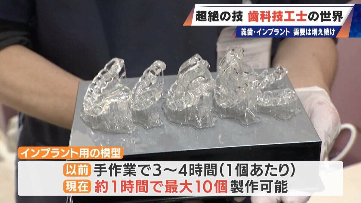 “入れ歯難民”に？減り続ける歯科技工士 現役の約半数が50歳以上 デジタル普及しても…かみ合わせはやっぱり“人間の手”