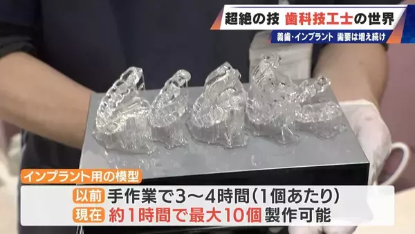 「“入れ歯難民”に？減り続ける歯科技工士 現役の約半数が50歳以上 デジタル普及しても…かみ合わせはやっぱり“人間の手”」の画像