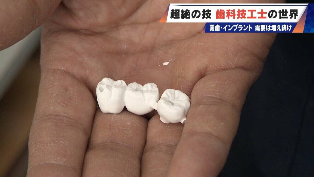 “入れ歯難民”に？減り続ける歯科技工士 現役の約半数が50歳以上 デジタル普及しても…かみ合わせはやっぱり“人間の手”
