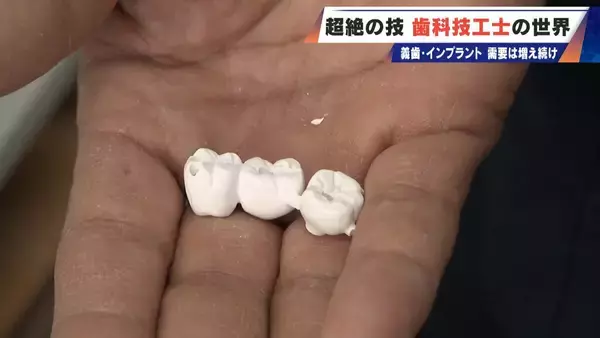 「“入れ歯難民”に？減り続ける歯科技工士 現役の約半数が50歳以上 デジタル普及しても…かみ合わせはやっぱり“人間の手”」の画像