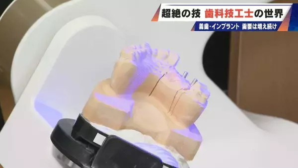 「“入れ歯難民”に？減り続ける歯科技工士 現役の約半数が50歳以上 デジタル普及しても…かみ合わせはやっぱり“人間の手”」の画像