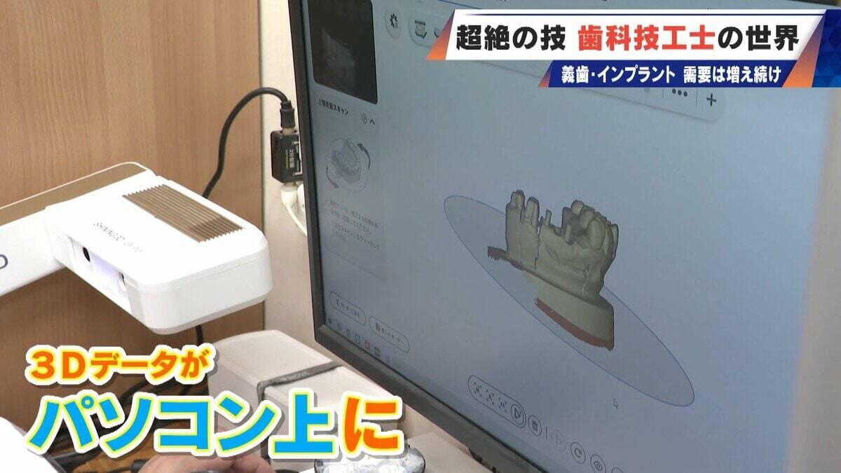 “入れ歯難民”に？減り続ける歯科技工士 現役の約半数が50歳以上 デジタル普及しても…かみ合わせはやっぱり“人間の手”