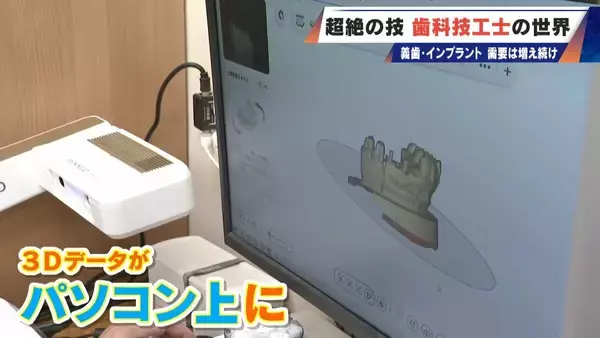 「“入れ歯難民”に？減り続ける歯科技工士 現役の約半数が50歳以上 デジタル普及しても…かみ合わせはやっぱり“人間の手”」の画像