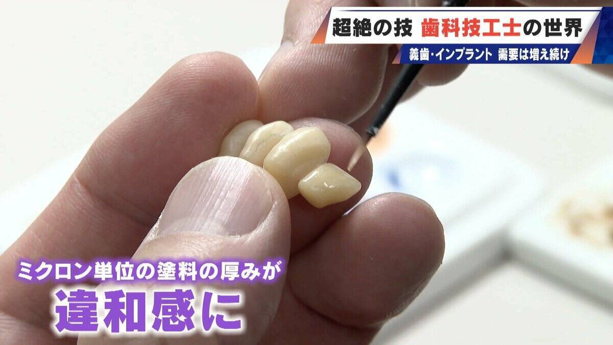 “入れ歯難民”に？減り続ける歯科技工士 現役の約半数が50歳以上 デジタル普及しても…かみ合わせはやっぱり“人間の手”