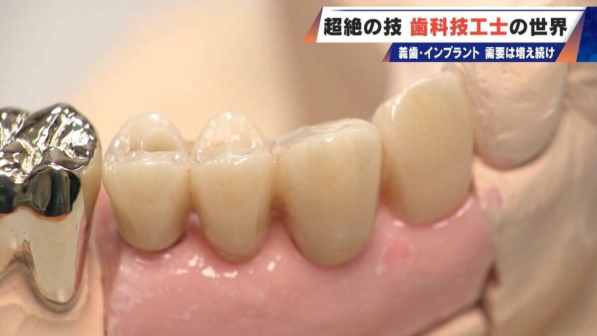 “入れ歯難民”に？減り続ける歯科技工士 現役の約半数が50歳以上 デジタル普及しても…かみ合わせはやっぱり“人間の手”