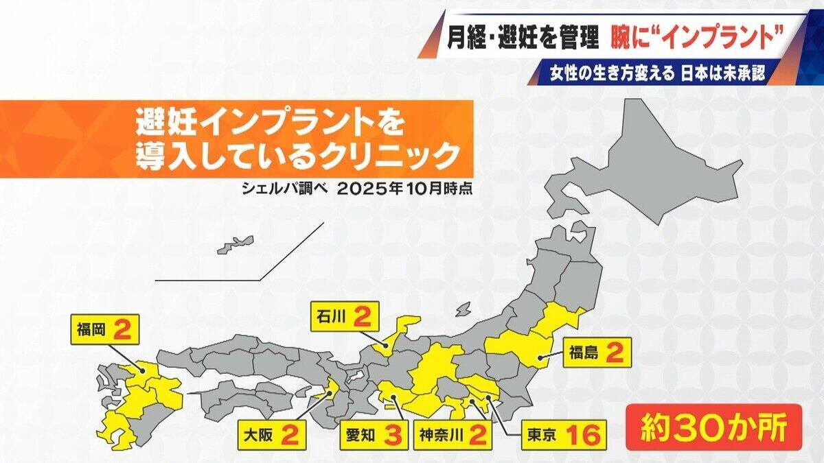 避妊･月経痛を軽減 腕に埋め込む4センチの“白い棒” 100か国以上で処方…しかし日本は未承認 ピルとは違う成分で血栓症のリスクが低い