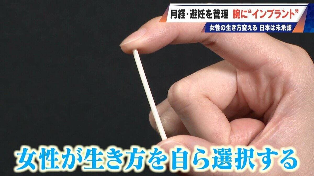 避妊･月経痛を軽減 腕に埋め込む4センチの“白い棒” 100か国以上で処方…しかし日本は未承認 ピルとは違う成分で血栓症のリスクが低い