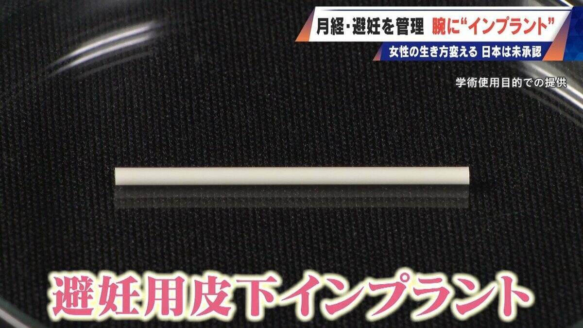 避妊･月経痛を軽減 腕に埋め込む4センチの“白い棒” 100か国以上で処方…しかし日本は未承認 ピルとは違う成分で血栓症のリスクが低い