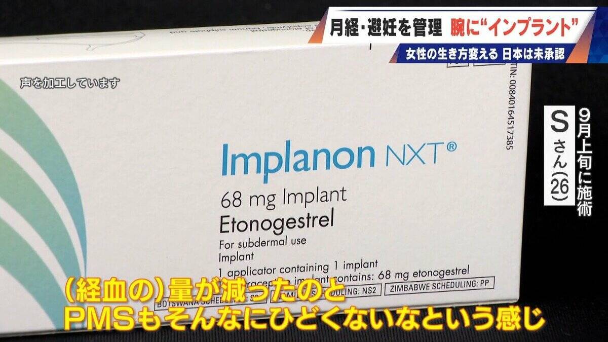 避妊･月経痛を軽減 腕に埋め込む4センチの“白い棒” 100か国以上で処方…しかし日本は未承認 ピルとは違う成分で血栓症のリスクが低い