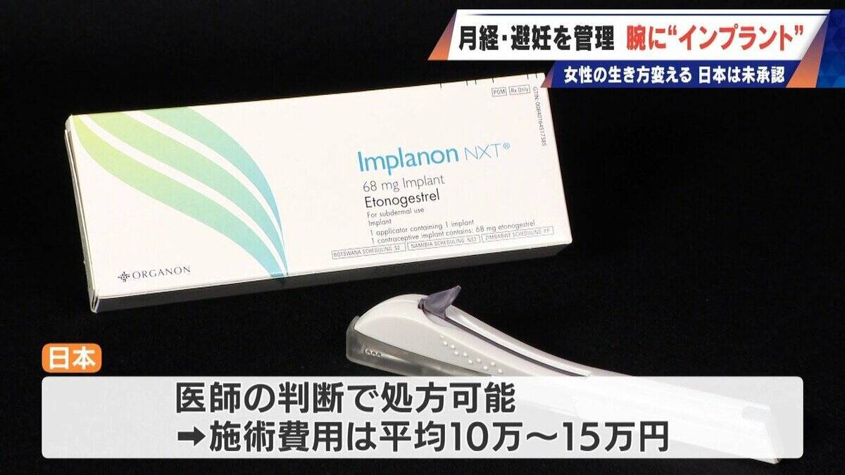 避妊･月経痛を軽減 腕に埋め込む4センチの“白い棒” 100か国以上で処方…しかし日本は未承認 ピルとは違う成分で血栓症のリスクが低い