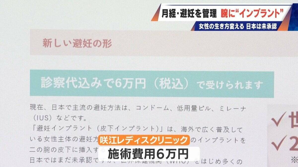 避妊･月経痛を軽減 腕に埋め込む4センチの“白い棒” 100か国以上で処方…しかし日本は未承認 ピルとは違う成分で血栓症のリスクが低い