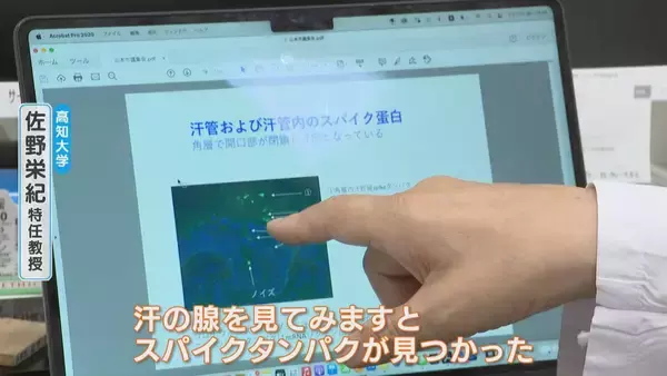 「腕や足に赤い“水ぶくれの跡” 新型コロナワクチン接種後 皮膚に湿疹が…医師は患部にワクチン由来の“ある物質”を発見【“ワクチン後遺症”を考える シリーズ10】」の画像