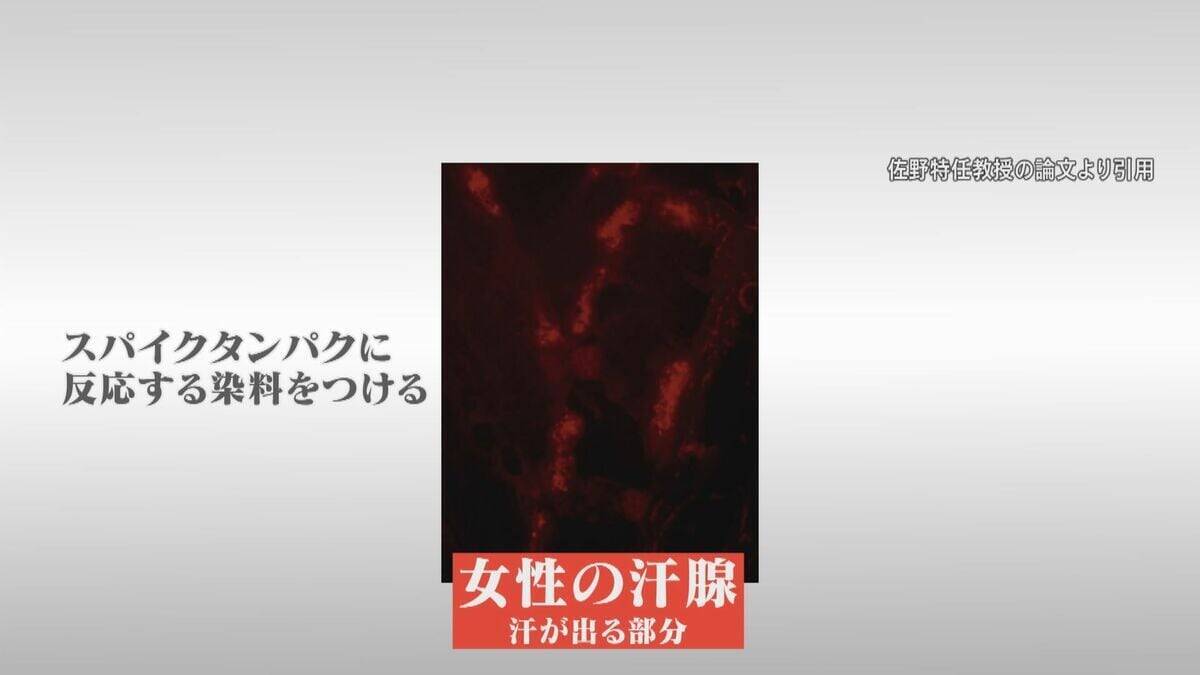 腕や足に赤い“水ぶくれの跡” 新型コロナワクチン接種後 皮膚に湿疹が…医師は患部にワクチン由来の“ある物質”を発見【“ワクチン後遺症”を考える シリーズ10】