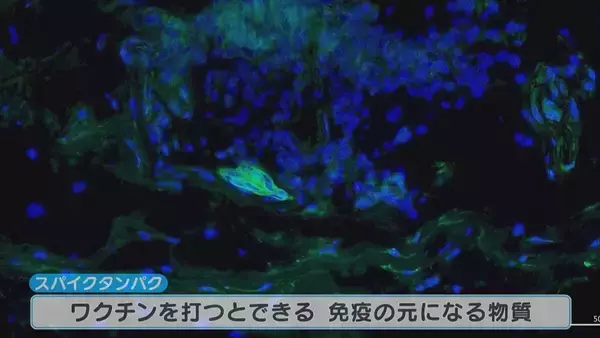 「腕や足に赤い“水ぶくれの跡” 新型コロナワクチン接種後 皮膚に湿疹が…医師は患部にワクチン由来の“ある物質”を発見【“ワクチン後遺症”を考える シリーズ10】」の画像