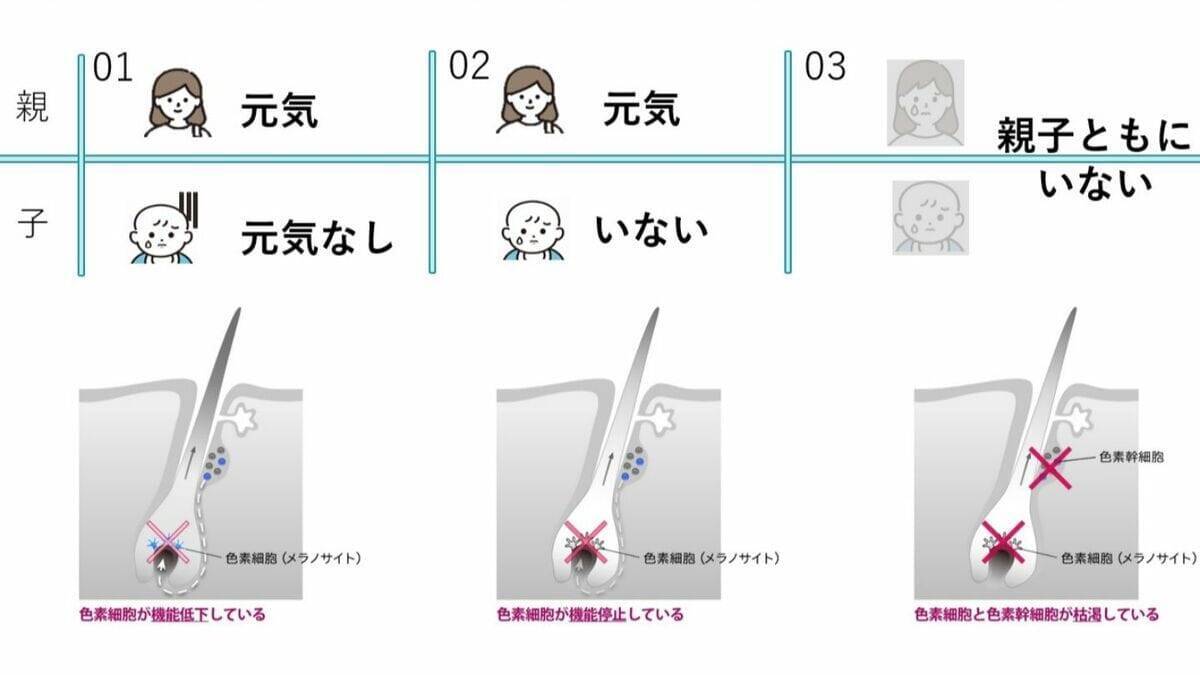 一度｢白髪｣になった毛は｢黒髪｣に戻る？白髪を抜くと増えるは本当？なぜ白髪は太く見えるの？美容院でのヘアカラーとセルフは何が違う？身近な疑問を徹底調査