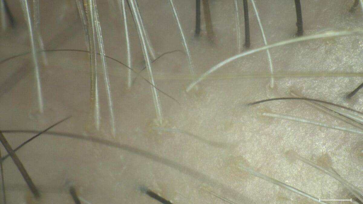 一度｢白髪｣になった毛は｢黒髪｣に戻る？白髪を抜くと増えるは本当？なぜ白髪は太く見えるの？美容院でのヘアカラーとセルフは何が違う？身近な疑問を徹底調査