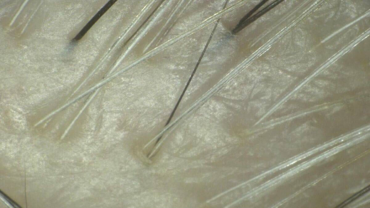 一度｢白髪｣になった毛は｢黒髪｣に戻る？白髪を抜くと増えるは本当？なぜ白髪は太く見えるの？美容院でのヘアカラーとセルフは何が違う？身近な疑問を徹底調査