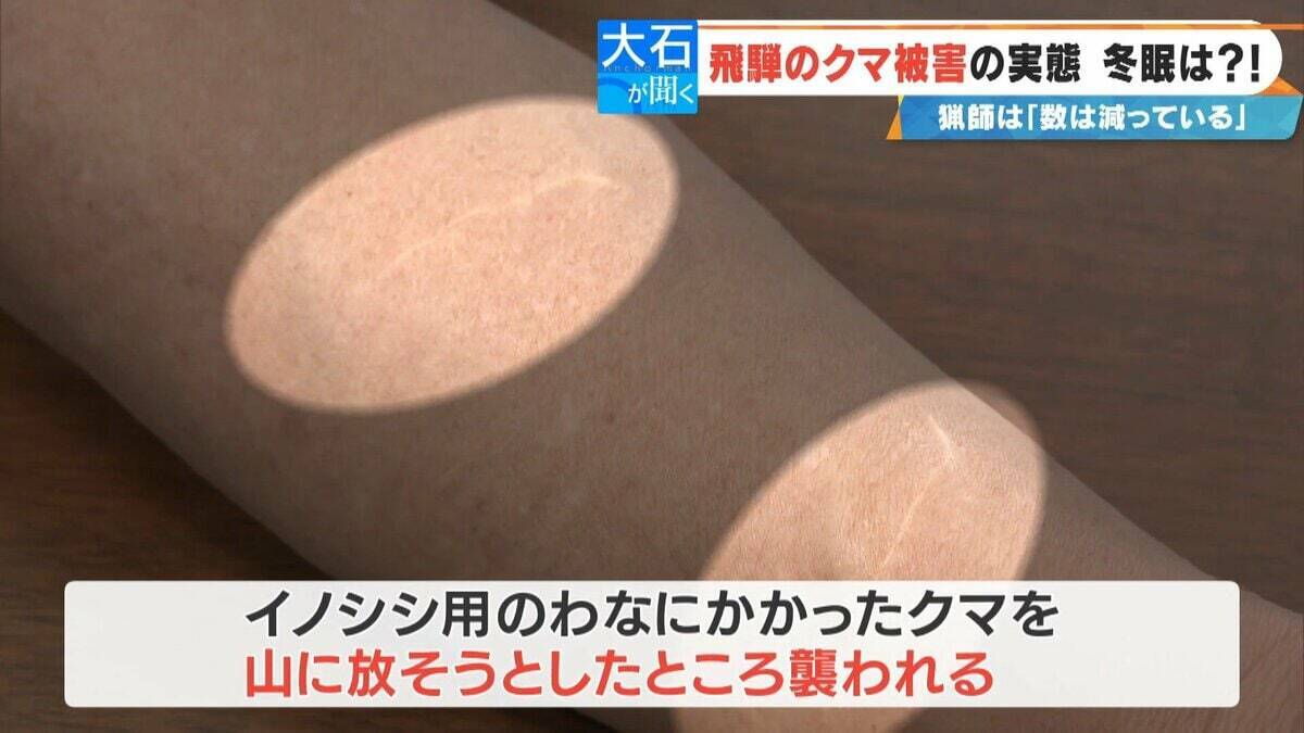 クマに恐われた男性｢これもうだめだと…｣ 過去最悪の被害の一方で猟友会は｢数が減ってきている｣ 駆除されたクマの“ある特徴”とは