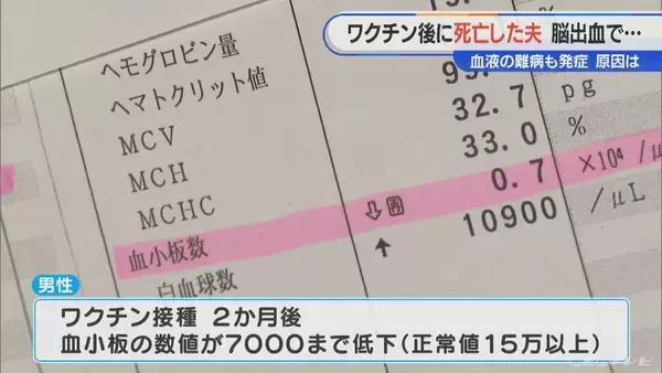 「顔中に赤黒い内出血が… 手足も膨れ上がる 新型コロナワクチン接種後に夫が難病を発症し死亡 ｢検証されないと無駄死に」【“ワクチン後遺症”を考える シリーズ9】」の画像