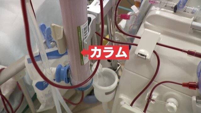 透析やMRIができなくなる恐れも…医療現場に迫る危機 医師｢やっていけない｣ 深刻化する“石油危機”