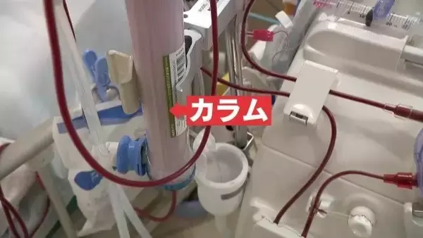 「透析やMRIができなくなる恐れも…医療現場に迫る危機 医師｢やっていけない｣ 深刻化する“石油危機”」の画像