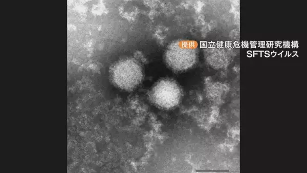 「マダニ感染症｢SFTS｣ 80代女性が感染 病院で治療続く… 愛知県内での確認はことし初 冬も注意を 豊田市」の画像