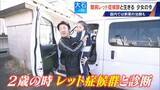 「｢2歳の頃はママ･パパと呼んでくれたのに…｣ 1万人に1人 主に女の子に発症する難病“レット症候群” 期待高まる｢新薬｣の治験･遺伝子治療」の画像6