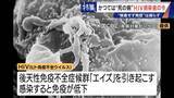 「かつて｢死の病｣と呼ばれ…20年前HIVに感染した男性の今 1日2粒で“普通の生活”できるのに消えない偏見 ｢性的接触あれば、誰もが感染リスクある。検査し早期発見を｣」の画像2