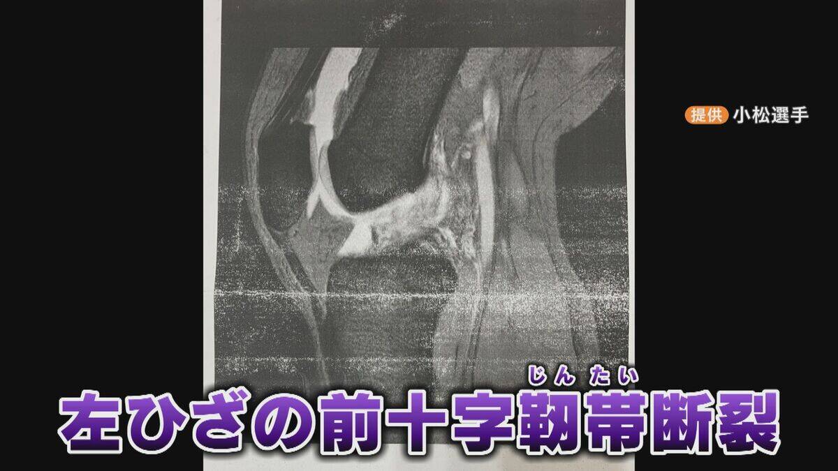 ｢もう終わった…｣ 膝は“ありえない方向”に 強豪バスケ部 岐阜女子高校のエースを襲った悲劇 指導歴約50年の監督が教え続けた“感謝”とは