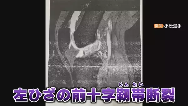 「｢もう終わった…｣ 膝は“ありえない方向”に 強豪バスケ部 岐阜女子高校のエースを襲った悲劇 指導歴約50年の監督が教え続けた“感謝”とは」の画像