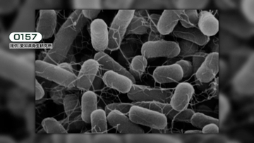 腸管出血性大腸菌「O157」の脅威　過去には死者や1万人近い大規模被害も　コストコ「ハイローラー」食中毒でも男児1人が重症に　改めて知るべき“今すぐできる”予防策