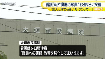 臓器の写真をSNSに投稿 「友人に見てもらいたくなり･･･」 大垣市民病院の看護師
