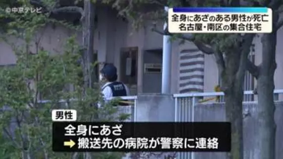 全身にあざのある男性が死亡　名古屋・南区の集合住宅