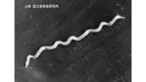 風俗産業利用の男性約５５％　愛媛の梅毒感染は今年に入り１５５人確認　過去最多をすでに超える【愛媛】