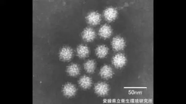「愛媛で感染性胃腸炎の確認が今年最多に　１医療機関平均で１０．１５人　西条保健所エリアで急増【愛媛】」の画像