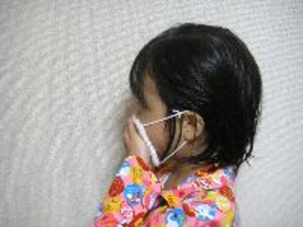 子どもの病気 大人にうつると重くなるのはなぜ 2007年11月13日 エキサイトニュース