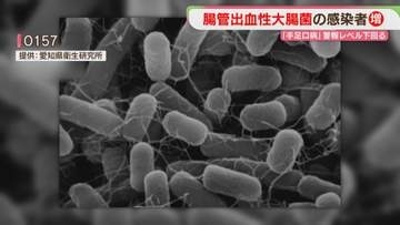 O157など腸管出血性大腸菌の感染者数が増加　手足口病「警報レベル」下回る　福岡