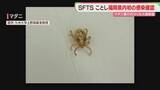 「マダニ媒介のウイルス感染症「SFTS」福岡でことし初の確認　注意点は」の画像1