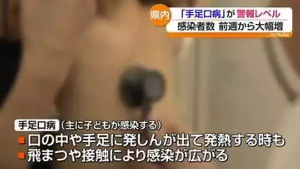 手足口病　福島県内も警報レベルに